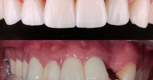 Neosmile, consultorio dental en Pachuca, Hidalgo