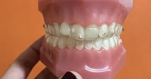 Ortho Dent | Dentista Tula, consultorio dental en Tula de Allende, Hidalgo