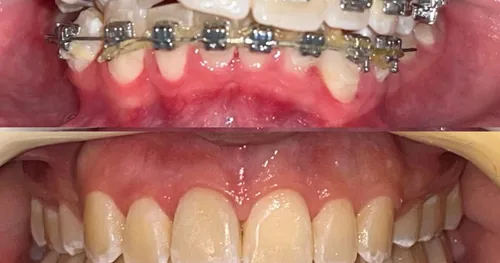 DenArT-Morelia, consultorio dental en Morelia, Michoacán