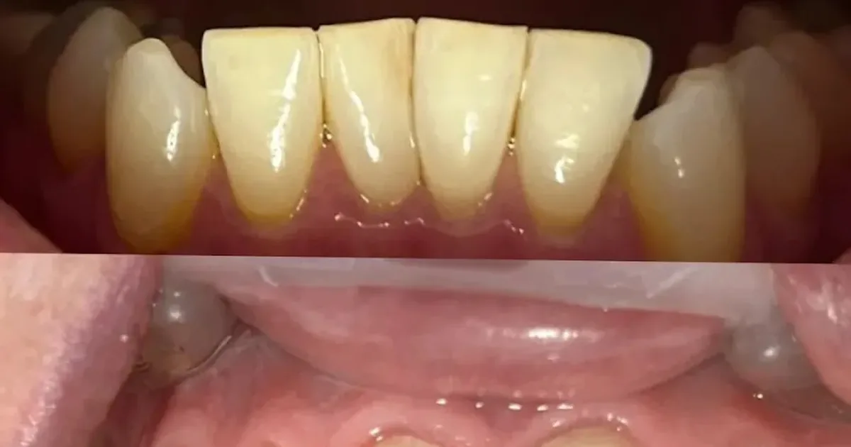 Cira dental