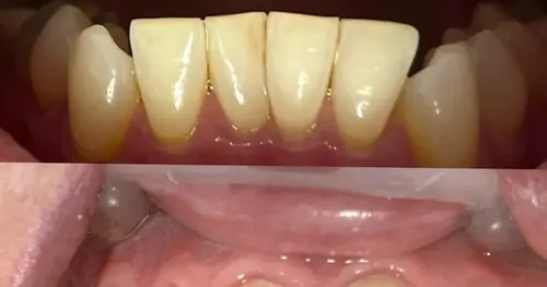 Cira dental, consultorio dental en Morelia, Michoacán