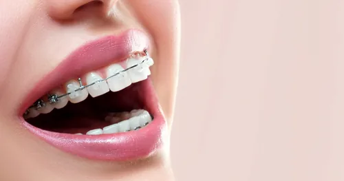 2M&E Dental, consultorio dental en Cuernavaca, Morelos