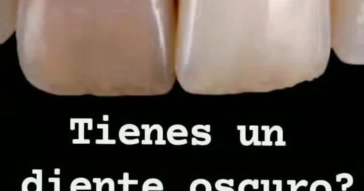 BG Dental Especializada en Santa Lucía del camino