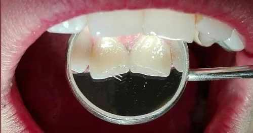 CONSULTORIO DE ODONTOLOGIA Y MEDICINA INTEGRAL Y ESTETICA DR. ANGEL ISRAEL SEVILLA, consultorio dental en Puebla, Puebla