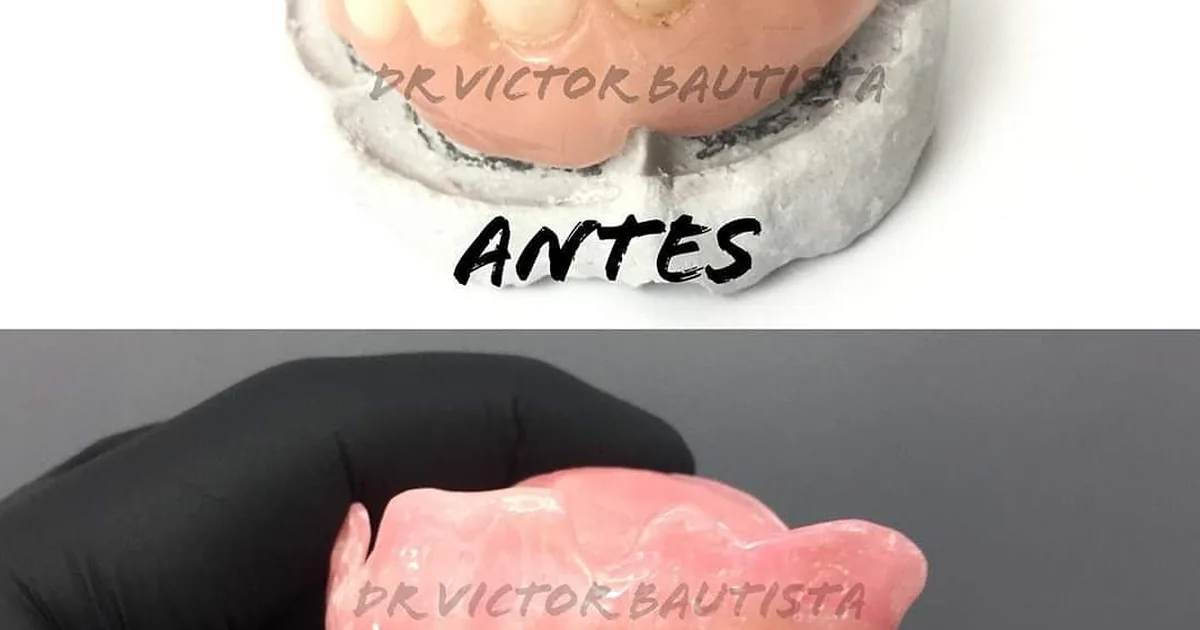 Dentista en Puebla Dentanium