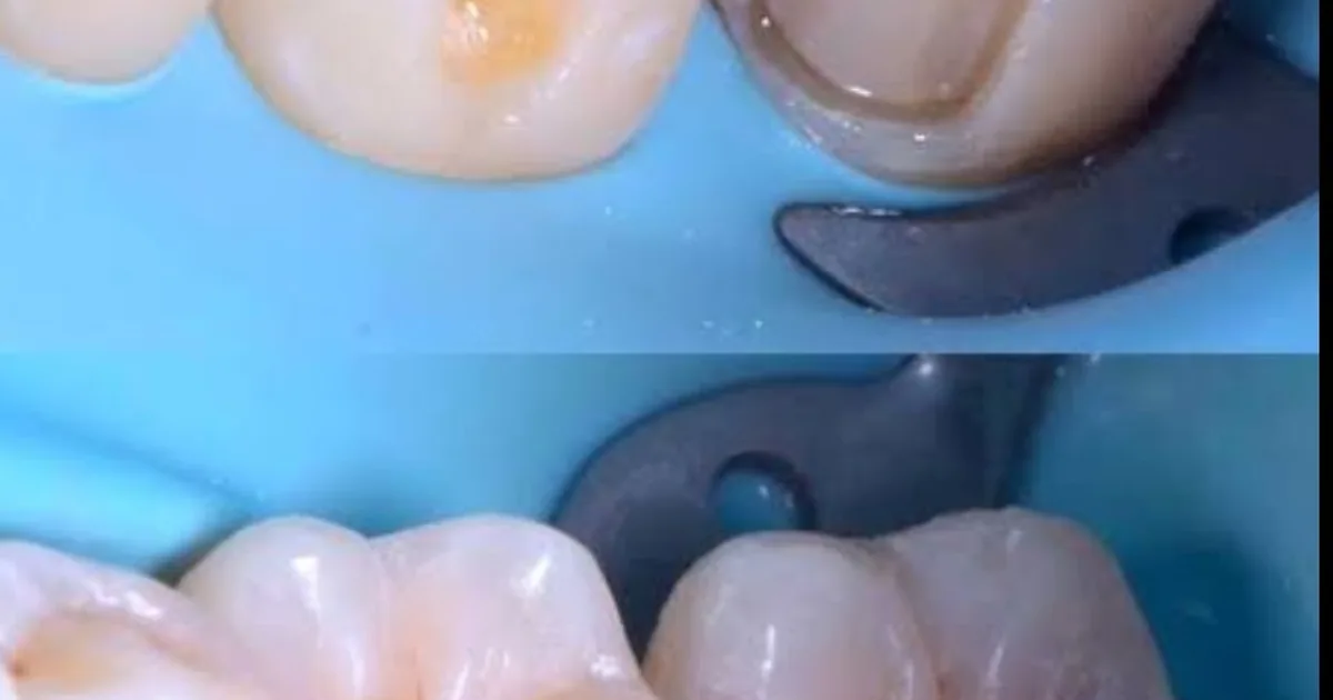 Dentalitz Especialidades Dentales