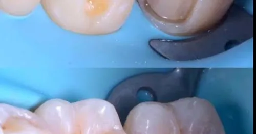 Dentalitz Especialidades Dentales, consultorio dental en Cholula, Puebla