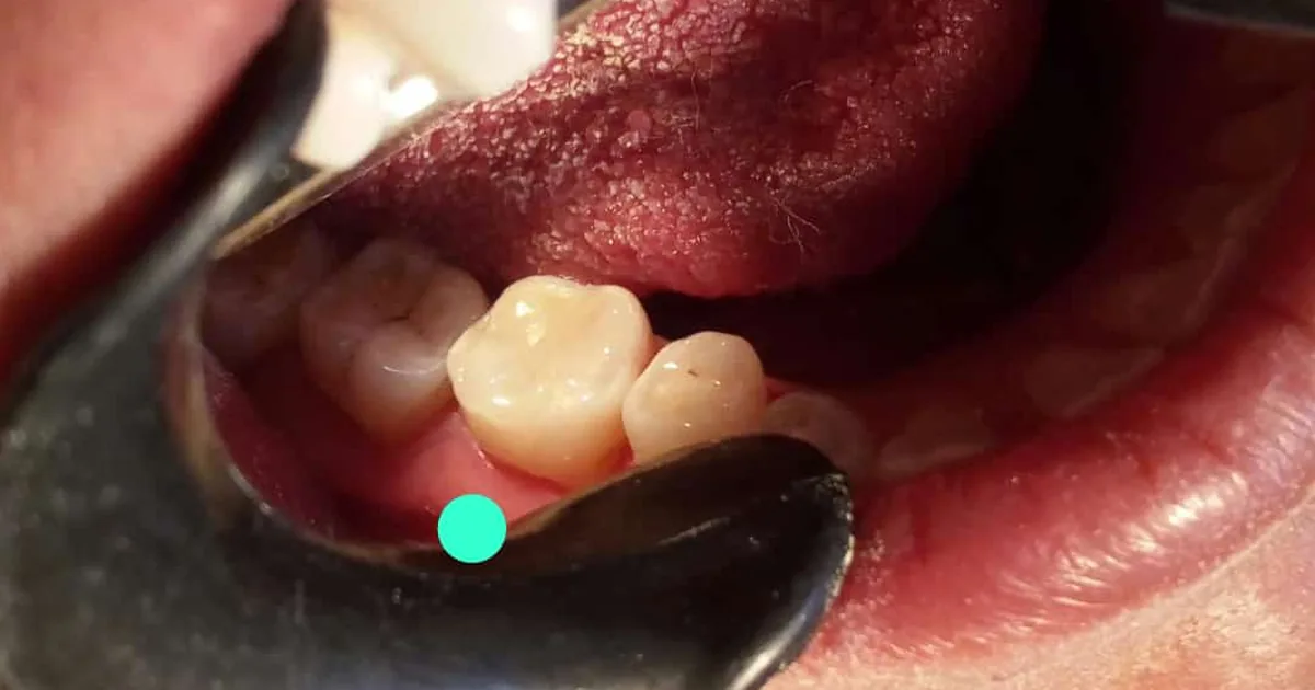 Odontología Preventiva AVIRUE