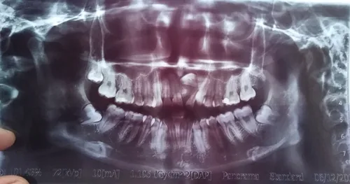 Haitah dental, consultorio dental en Cholula, Puebla