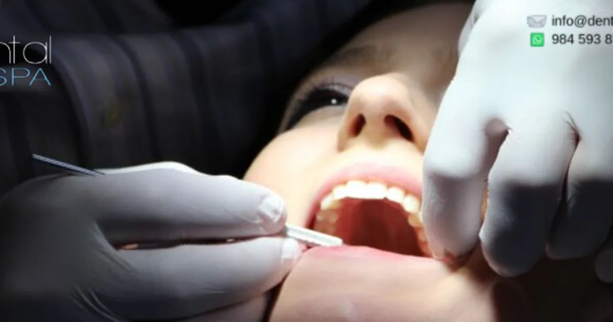 Dental Spa Playa del Carmen
