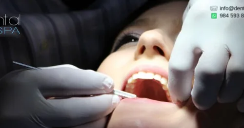 Dental Spa Playa del Carmen, consultorio dental en Playa del Carmen, Quintana Roo