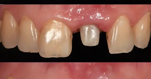 Dentch Dentista, consultorio dental en Playa del Carmen, Quintana Roo