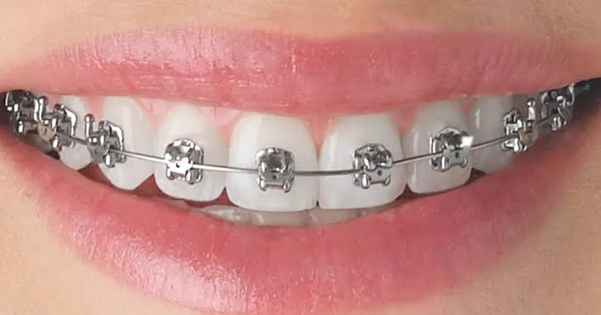 DentalLandero