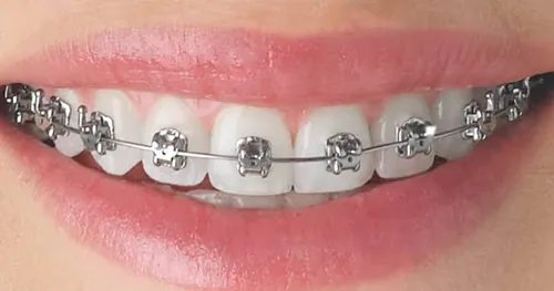 DentalLandero, consultorio dental en Nacajuca, Tabasco