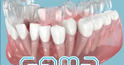 Gema, dentista, ortodoncia y Maxilofacial Tlaxcala, consultorio dental en Tlaxcala, Tlaxcala