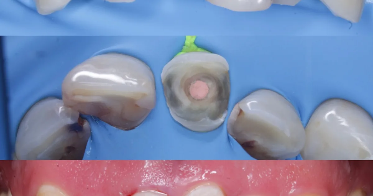 Cirujano Dentista Abraham Rojas Campos MexDent