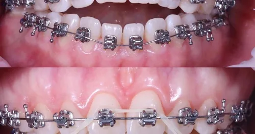 Cirujano Dentista A.C.M., consultorio dental en Apizaco, Tlaxcala