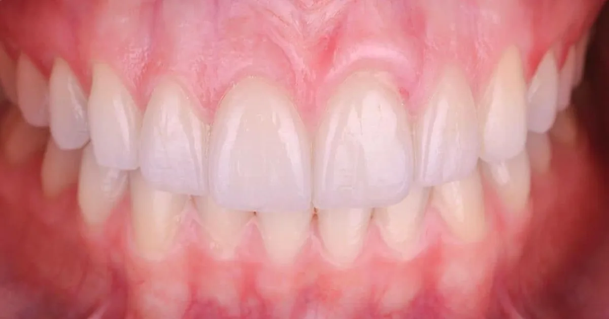 Dentista Gustavo Gaytán Salim