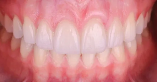 Dental Olympus Orizaba, consultorio dental en Orizaba, Veracruz