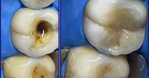 Dental VIDA – Dentista en Orizaba, consultorio dental en Orizaba, Veracruz