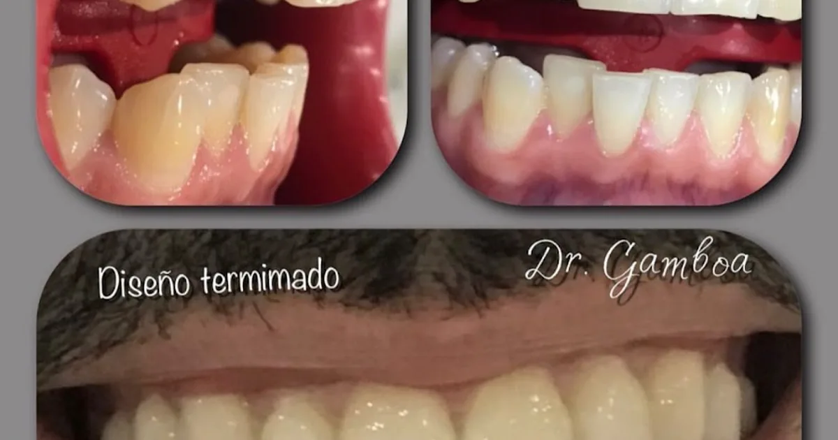 Clínica Dental DR.GAMBOA