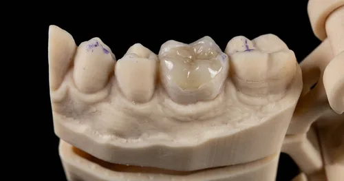 Isdental Xalapa | Alta especialidad en Ortodoncia y Rehabilitación Dental, consultorio dental en Xalapa, Veracruz