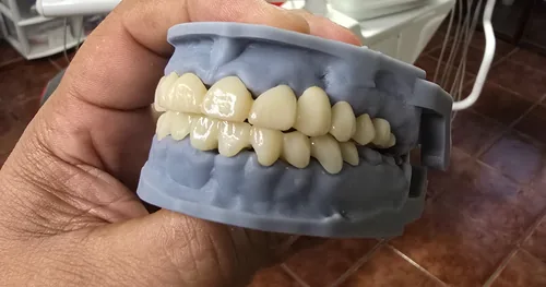 ✅ Dentista SH Dental, consultorio dental en Xalapa, Veracruz