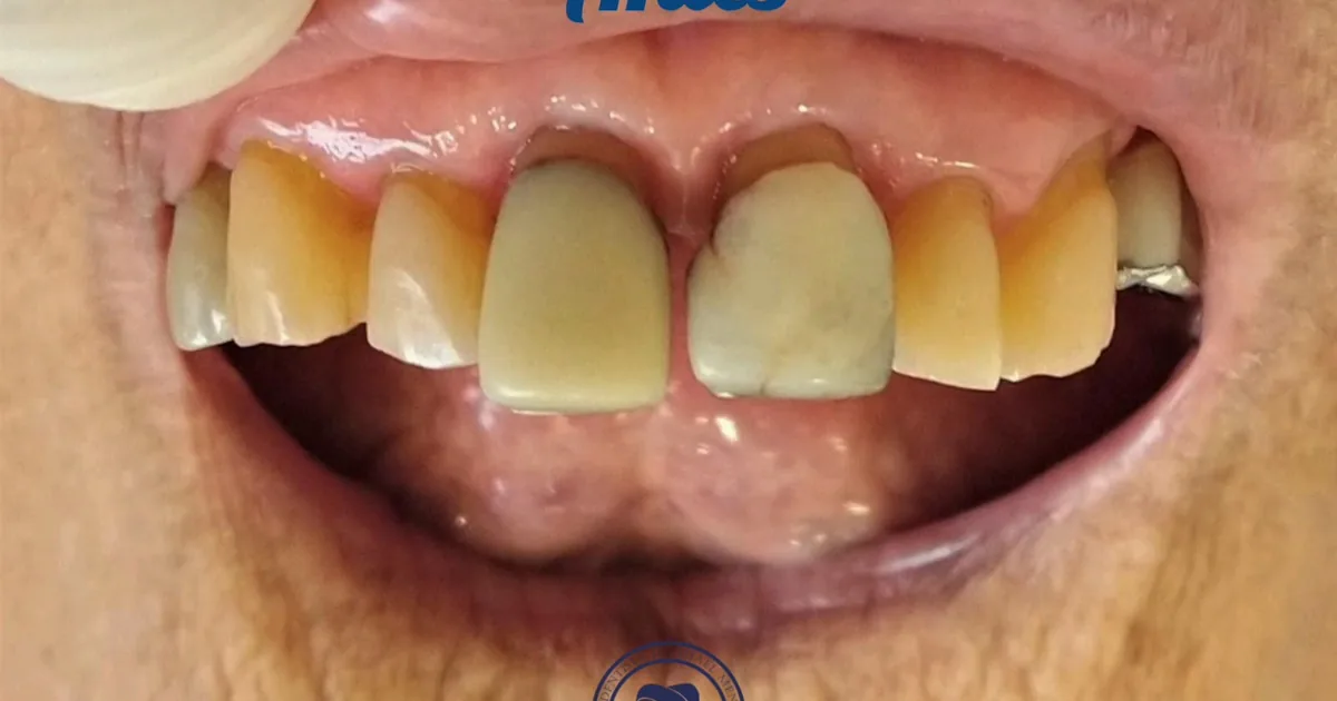 Dental Moon. Cirujano Dentista Danhael Méndez Luna