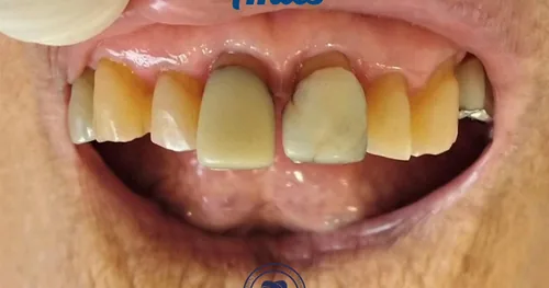 Dental Moon. Cirujano Dentista Danhael Méndez Luna, consultorio dental en Xalapa, Veracruz