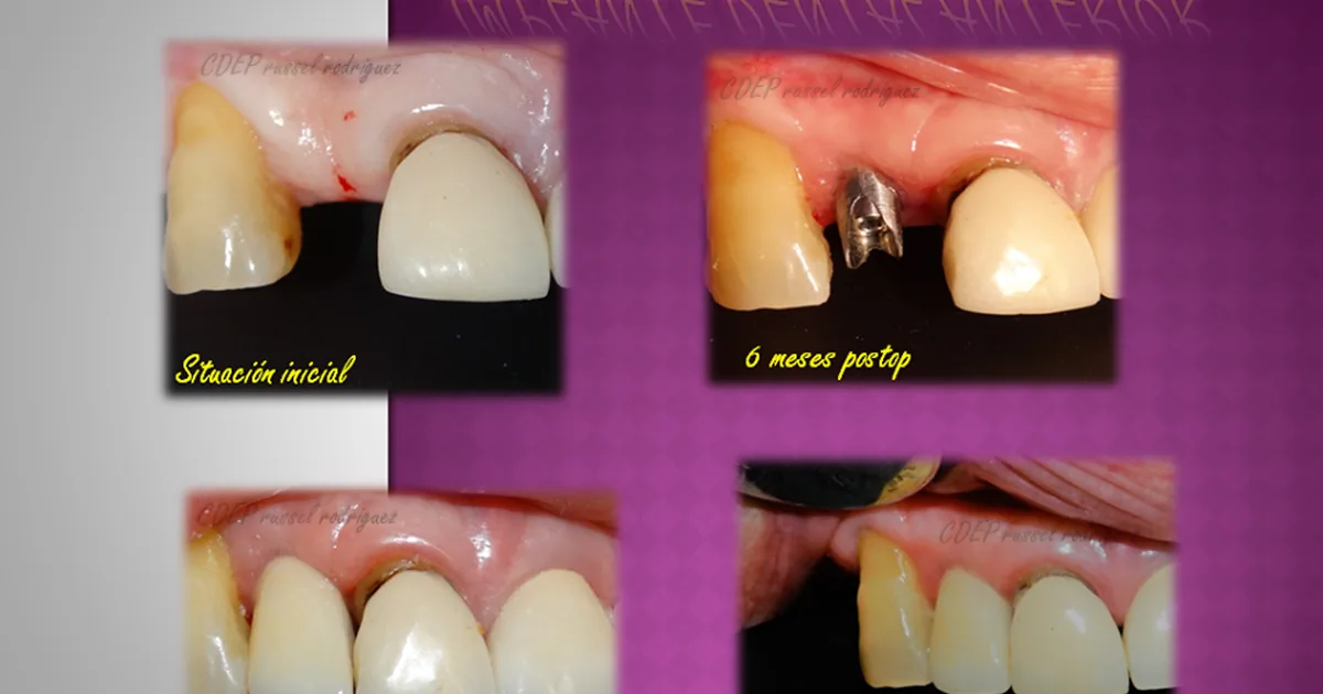 Confort Dental